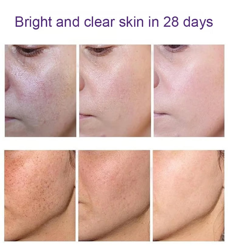Fade the Look of Freckles & Dark Spots for a Brighter, More Even Glow