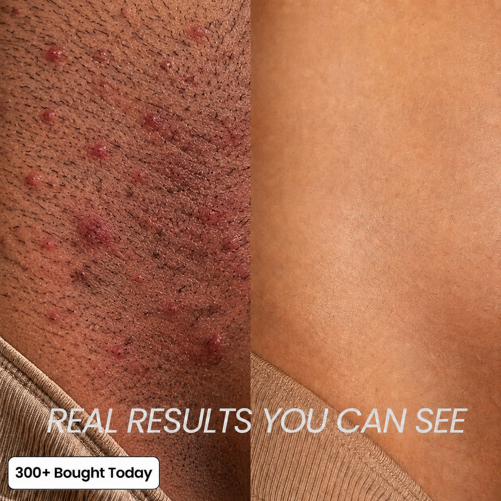 Anti-Hair Growth Oil