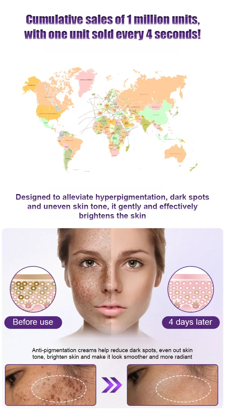 Fade the Look of Freckles & Dark Spots for a Brighter, More Even Glow