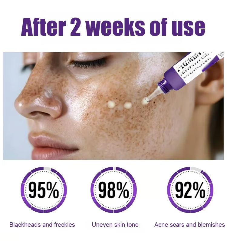 Fade the Look of Freckles & Dark Spots for a Brighter, More Even Glow