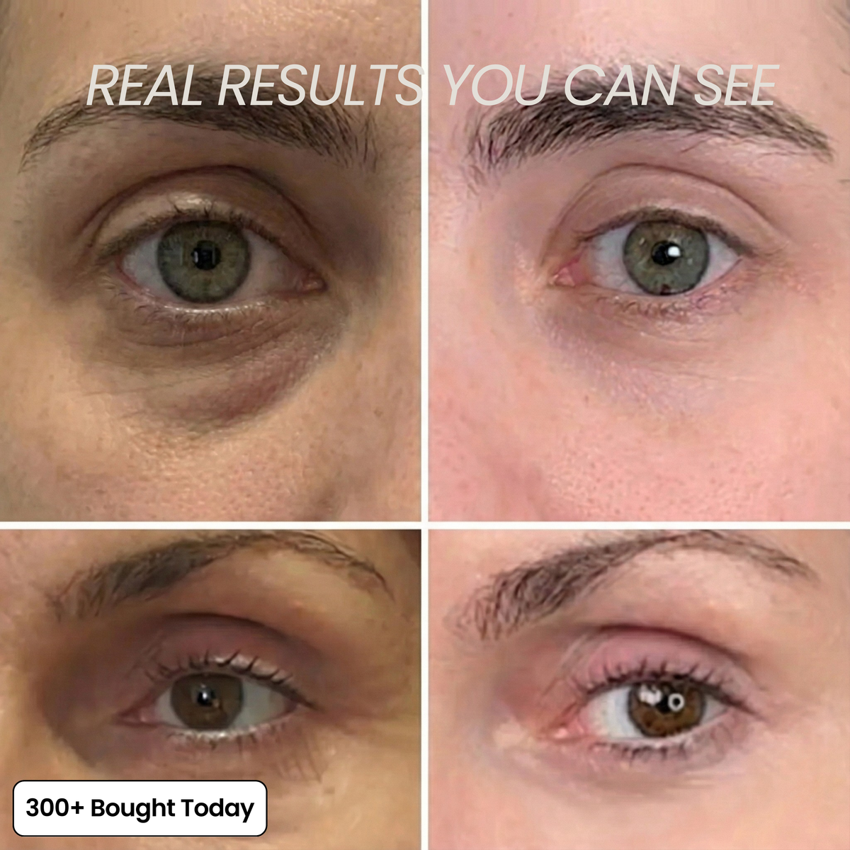Transform Wrinkles, Fine Lines, And Tired Creases Naturally